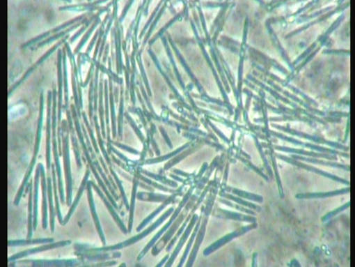 Megabakterien, Macro rhabdus